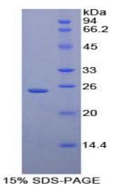 SDS-PAGE (CD79A-6887H).jpg